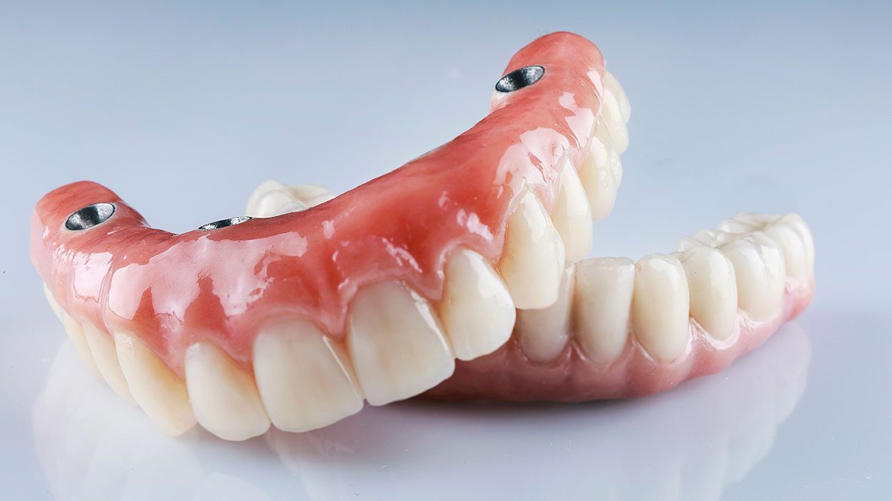 dental implants Warren RI