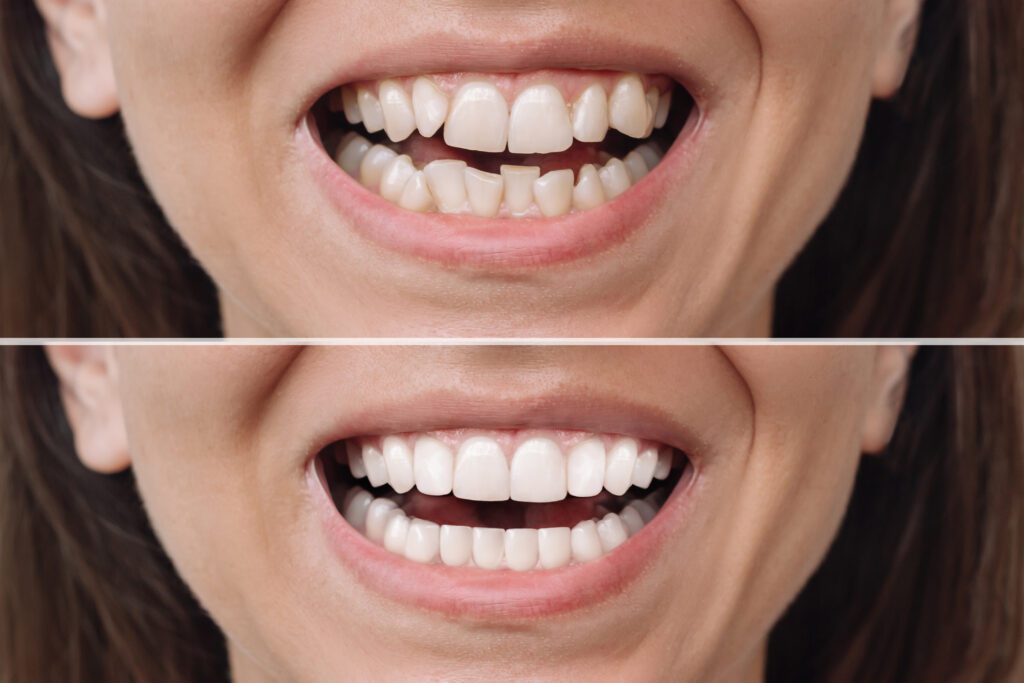 cosmetic dentistry in Barrington