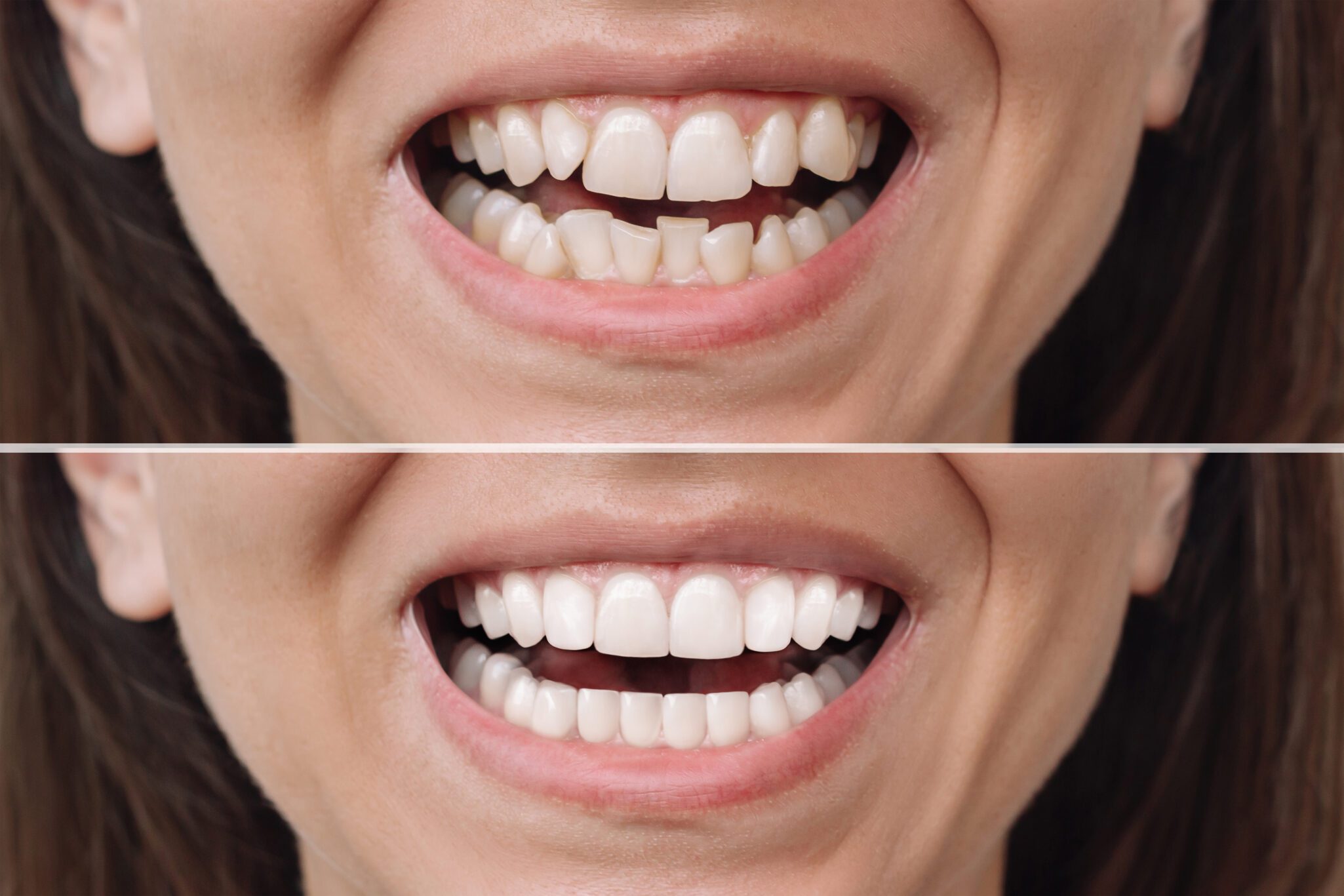 cosmetic dentistry in Barrington